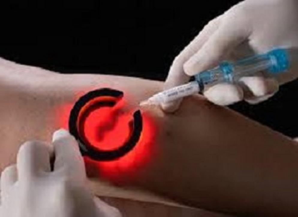 Vein Finder for Medical Profession