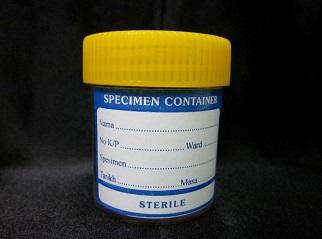 Urine Container