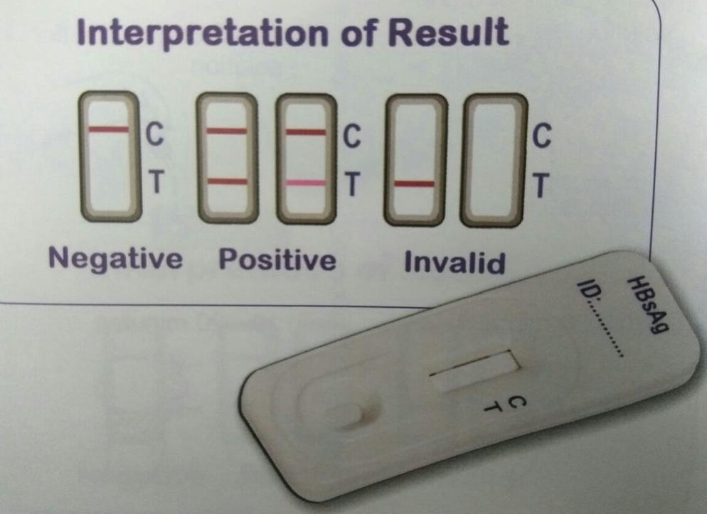 Hepatities B  Test