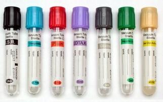 Blood collection Tube(Glucose,ESR,Plasma,Heparin,Serum,Gel&Clo,ACD,K2EDTA,etc) In Malaysia