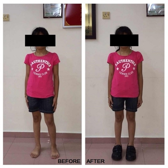 before and after