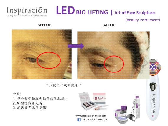 Slide11