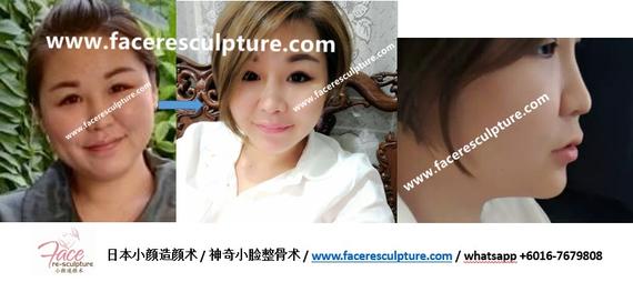 Face