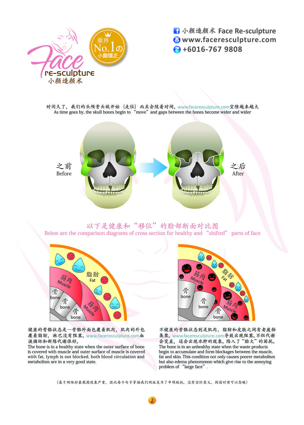 为什么小脸整骨术这么神奇？？Why Face Re-sculpture Works?