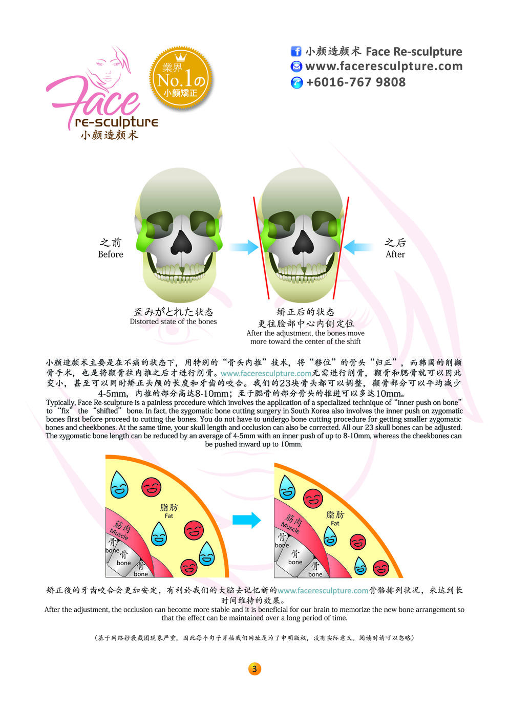 为什么小脸整骨术这么神奇？？Why Face Re-sculpture Works?