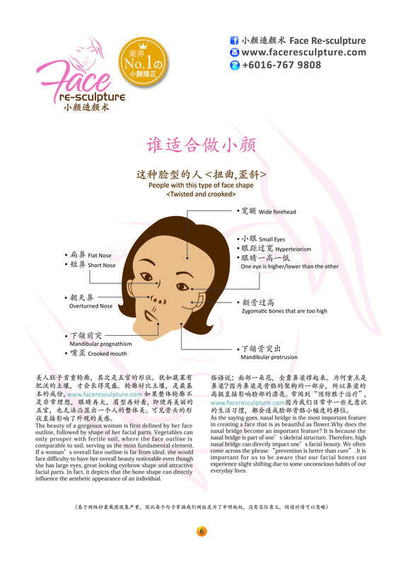 "小脸整骨术" 这么神奇，你适合做吗？Can you do Miracle Face Re-Sculpture?