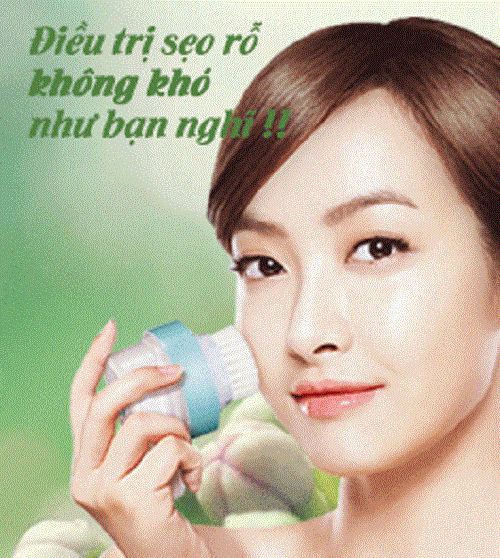 Điều trị sẹo rỗ