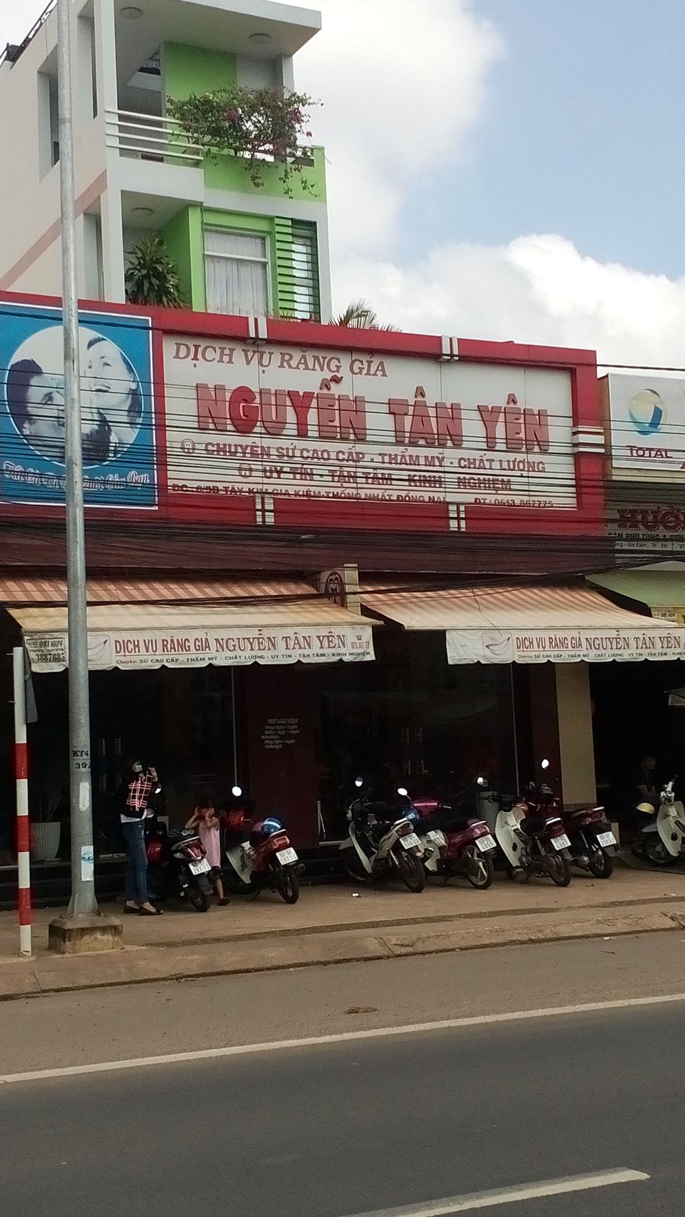 Dịch Vụ Răng Giả Nguyễn Tân Yên